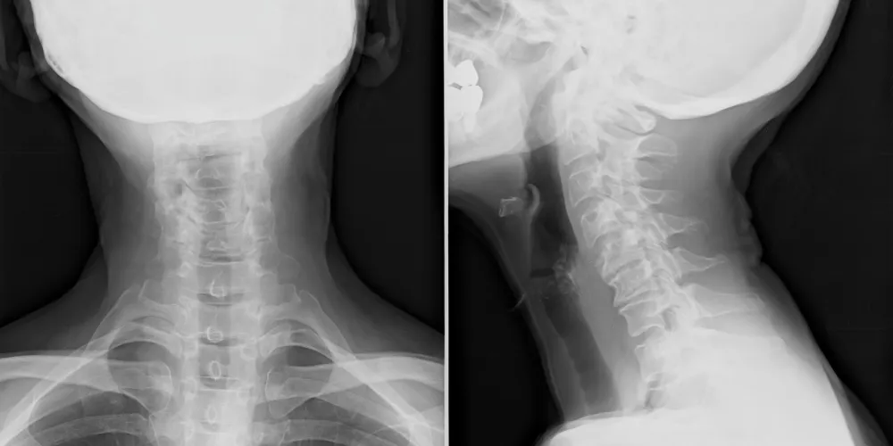 chiropractic xray CITY*